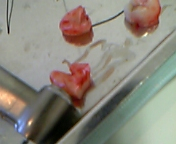 あぃだだだだだだだ